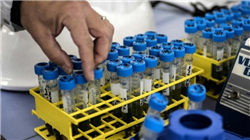 世界十大胖人，最重的人竟然想达到2000斤！